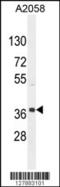 NFKB Activating Protein Like antibody, 55-276, ProSci, Western Blot image 