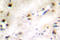 ZFP36 Ring Finger Protein Like 1 antibody, LS-C177336, Lifespan Biosciences, Immunohistochemistry paraffin image 