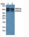 Acid Phosphatase, Prostate antibody, LS-C292592, Lifespan Biosciences, Western Blot image 