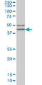 Sarcoglycan Beta antibody, LS-B4415, Lifespan Biosciences, Western Blot image 