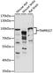 Transmembrane Serine Protease 7 antibody, LS-C750200, Lifespan Biosciences, Western Blot image 