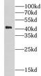 Carbohydrate sulfotransferase 11 antibody, FNab01691, FineTest, Western Blot image 