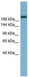 Transmembrane protein 2 antibody, TA346474, Origene, Western Blot image 