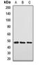 Alpha-N-Acetylgalactosaminidase antibody, LS-C667702, Lifespan Biosciences, Western Blot image 