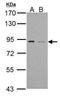 Phosphodiesterase 4B antibody, TA308931, Origene, Western Blot image 