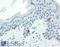 Tyrosinase antibody, LS-B2473, Lifespan Biosciences, Immunohistochemistry frozen image 