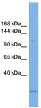 Ubiquitin Specific Peptidase 37 antibody, TA344750, Origene, Western Blot image 