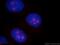 Abhydrolase Domain Containing 14B antibody, 20952-1-AP, Proteintech Group, Immunofluorescence image 