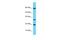 Uncharacterized protein C17orf102 antibody, A19037, Boster Biological Technology, Western Blot image 