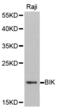 BCL2 Interacting Killer antibody, abx001932, Abbexa, Western Blot image 