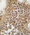 ALK Receptor Tyrosine Kinase antibody, 63-027, ProSci, Immunohistochemistry paraffin image 
