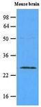 RAB5A, Member RAS Oncogene Family antibody, GTX53775, GeneTex, Western Blot image 