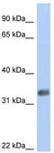 Purine Rich Element Binding Protein G antibody, TA339644, Origene, Western Blot image 