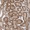 ETAA1 Activator Of ATR Kinase antibody, NBP1-90473, Novus Biologicals, Immunohistochemistry paraffin image 