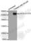 Acetyl-CoA Carboxylase Alpha antibody, AP0298, ABclonal Technology, Western Blot image 