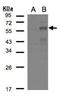 Early Growth Response 2 antibody, NBP2-16286, Novus Biologicals, Western Blot image 