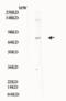 Interferon Alpha And Beta Receptor Subunit 2 antibody, XG-6162, ProSci, Western Blot image 