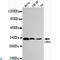 Cyclin Dependent Kinase 4 antibody, LS-C812910, Lifespan Biosciences, Western Blot image 