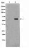 Autoimmune Regulator antibody, LS-C416026, Lifespan Biosciences, Western Blot image 