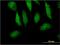 Myotrophin antibody, MA5-24520, Invitrogen Antibodies, Immunofluorescence image 
