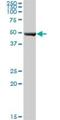 Nicotinate Phosphoribosyltransferase antibody, H00093100-B01P, Novus Biologicals, Western Blot image 