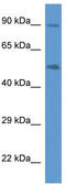 Cytochrome P450 Family 2 Subfamily W Member 1 antibody, TA343055, Origene, Western Blot image 