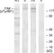 Protein Tyrosine Kinase 2 antibody, LS-C117355, Lifespan Biosciences, Western Blot image 