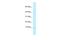 Barrier To Autointegration Factor 2 antibody, A09013, Boster Biological Technology, Western Blot image 