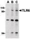 Toll Like Receptor 6 antibody, LS-B1419, Lifespan Biosciences, Western Blot image 