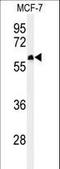 FAM20A Golgi Associated Secretory Pathway Pseudokinase antibody, LS-C167897, Lifespan Biosciences, Western Blot image 