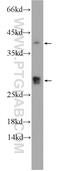 Centromere Protein N antibody, 16751-1-AP, Proteintech Group, Western Blot image 