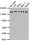 Insulin Receptor Related Receptor antibody, CSB-PA011755LA01HU, Cusabio, Western Blot image 
