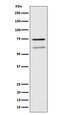 WD Repeat Domain 1 antibody, M04814, Boster Biological Technology, Western Blot image 