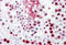 Heterogeneous Nuclear Ribonucleoprotein L antibody, MBS247000, MyBioSource, Immunohistochemistry paraffin image 