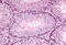 GLI Family Zinc Finger 2 antibody, MBS240221, MyBioSource, Immunohistochemistry paraffin image 