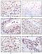 Lysine Acetyltransferase 8 antibody, NBP1-28879, Novus Biologicals, Immunohistochemistry paraffin image 