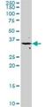 Fibroblast Growth Factor 8 antibody, H00002253-M01, Novus Biologicals, Western Blot image 