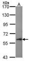 Perforin 1 antibody, GTX102379, GeneTex, Western Blot image 