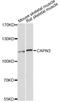 Calpain 3 antibody, LS-C747225, Lifespan Biosciences, Western Blot image 
