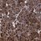 ATP Binding Cassette Subfamily F Member 2 antibody, NBP1-89318, Novus Biologicals, Immunohistochemistry paraffin image 