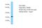 Olfactory Receptor Family 56 Subfamily B Member 1 antibody, A16374, Boster Biological Technology, Western Blot image 