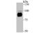 Protein Kinase D2 antibody, A04056-1, Boster Biological Technology, Western Blot image 