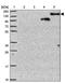 Negative regulator of transcription subunit 1 homolog antibody, NBP2-31892, Novus Biologicals, Western Blot image 