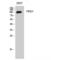 Serine/threonine-protein kinase D1 antibody, LS-C385555, Lifespan Biosciences, Western Blot image 