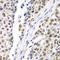 ER Lipid Raft Associated 2 antibody, orb326257, Biorbyt, Immunohistochemistry paraffin image 