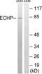 Enoyl-CoA Hydratase And 3-Hydroxyacyl CoA Dehydrogenase antibody, LS-C120196, Lifespan Biosciences, Western Blot image 