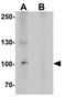 KN motif and ankyrin repeat domain-containing protein 2 antibody, GTX31536, GeneTex, Western Blot image 