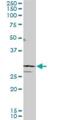 SIX Homeobox 3 antibody, H00006496-M10, Novus Biologicals, Western Blot image 