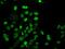 Ubiquitin Conjugating Enzyme E2 E3 antibody, MA5-26359, Invitrogen Antibodies, Immunocytochemistry image 