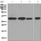 HLA class II histocompatibility antigen, DRB1-15 beta chain antibody, ab133578, Abcam, Western Blot image 